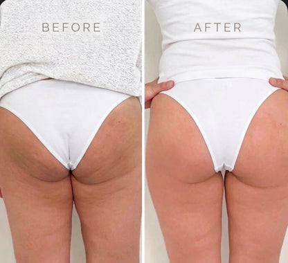 Tite™ Overnight Full Body Toning, Firming & Sculpt Whip
